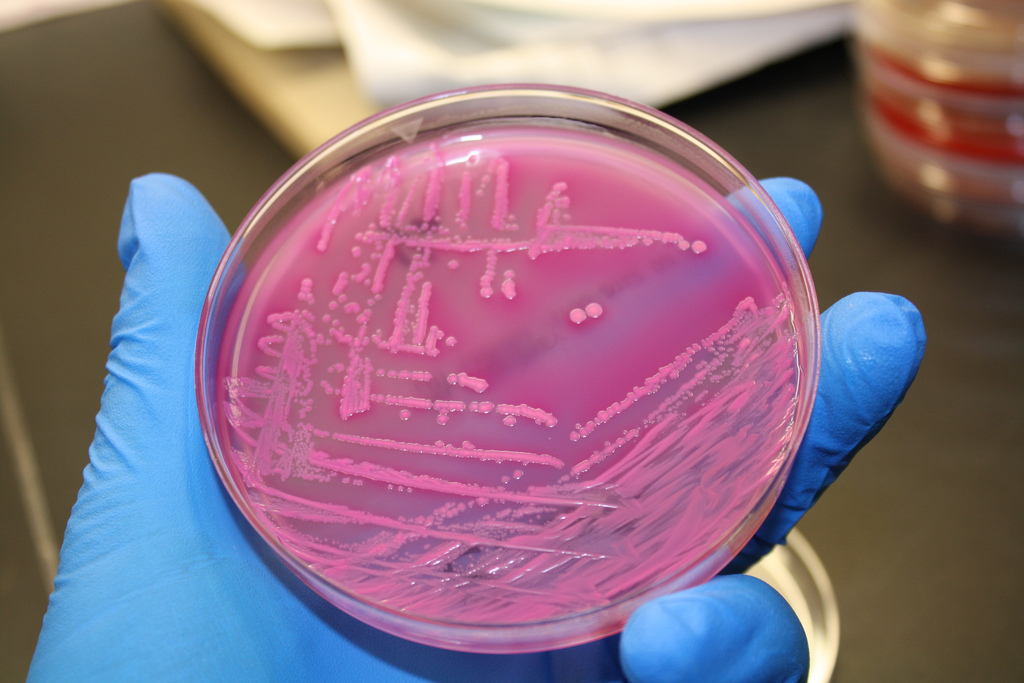 Harnessing Genetically Modified Bacteria for Environmental Cleaning Applications